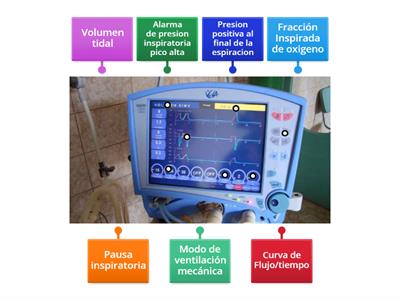 Ventilación mecánica