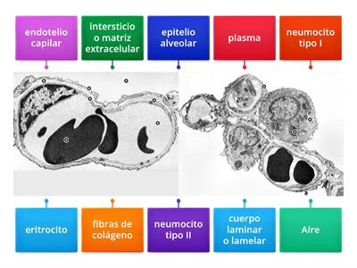 Barrera alveolo capilar