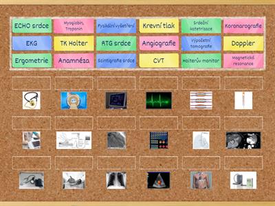 Vyšetřovací metody u onemocnění srdce 