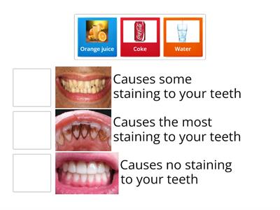 Teeth Staining