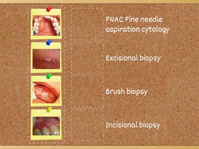 Match the lesion to the most appropriate method of Biopsy