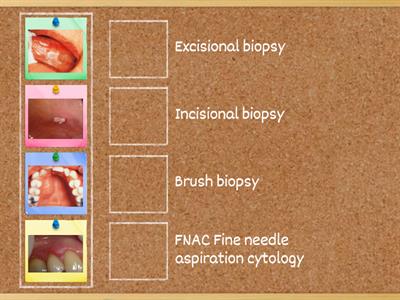 Match the lesion to the most appropriate method of Biopsy