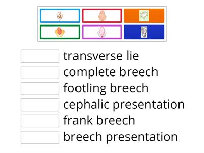 Foetus Presentations