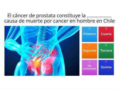 Prevención cáncer de prostata