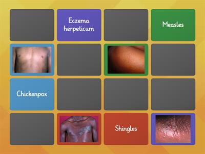 Skin rash presentations on darker skin