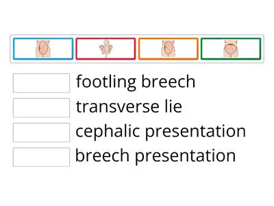 U11,MDE, D/4, foetus positions and presentations 