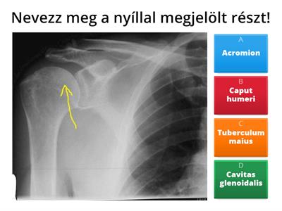 Anatómia Váll.