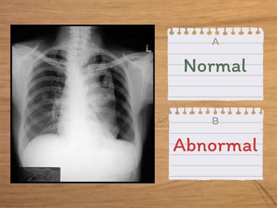 Red Dot or Not? Radiology x-ray quiz