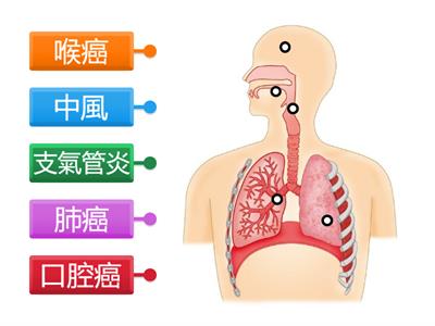 LKW - 由吸煙引致的一些疾病