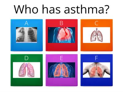 severe asthma attack