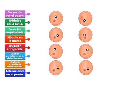 Identifica los principales síntomas del cáncer de mama. 