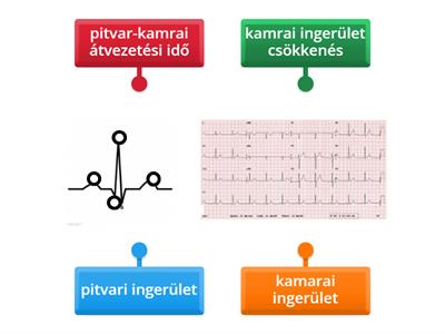 Sydänkäyrän lukeminen