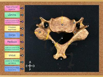 Anatomia VÉRTEBRA TÍPICA - CERVICAL