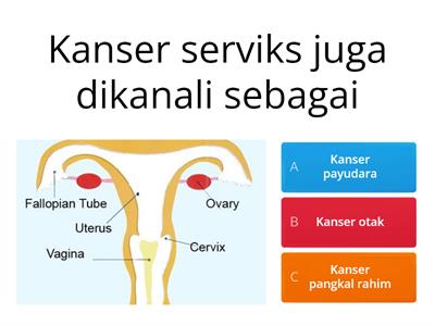 Pjpk tingkatan 1 - Penyakit (kanser serviks)