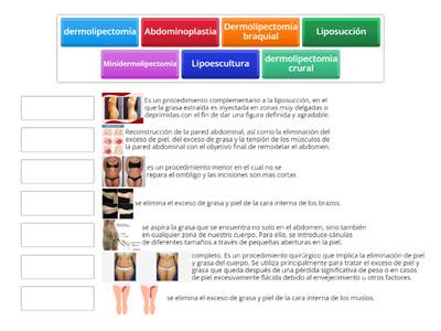 Cirugias De Abdomen