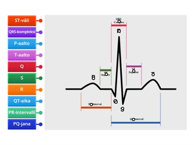 Sydänkäyrä eli EKG