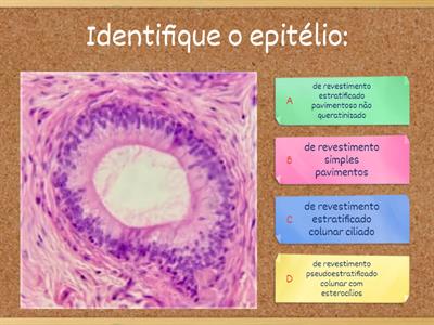 Tecido Epitelial - Laminário Virtual de Histologia da UFCSPA (https://ufcspa.edu.br/disciplinas/histologia/)