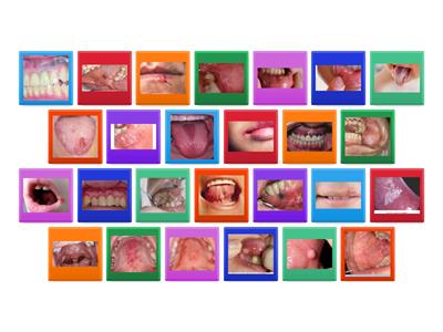 Lesiones que afectan a la mucosa oral