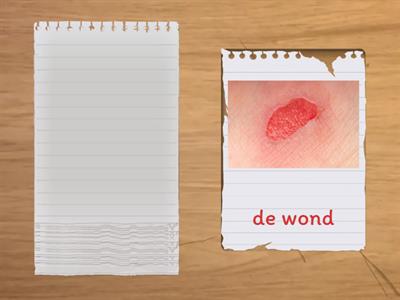 Wereld vol woorden thema B3| Ra ra... wat is het? | naar de dokter