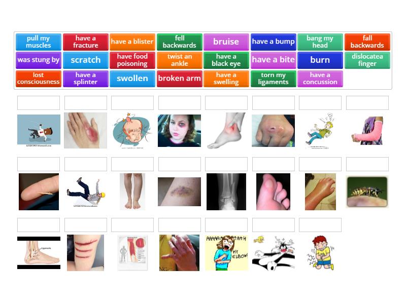 INJURIES - Match up