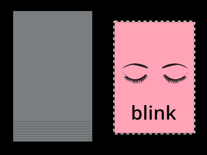 Is Speech Therapy Special Ed