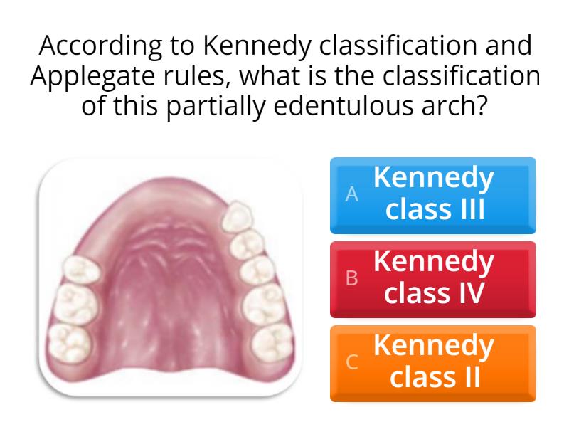 Kennedy Classification Quiz