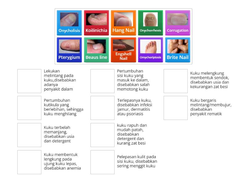 Kelainan Kuku - Match up