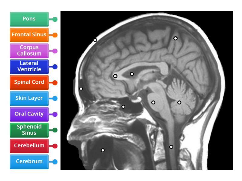 MRI BRAIN LABELLING 1 - Labelled diagram