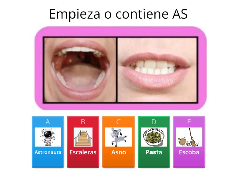 FONEMA /S/ INVERSO (Articulemas De Siembra Estrellas) - Quiz