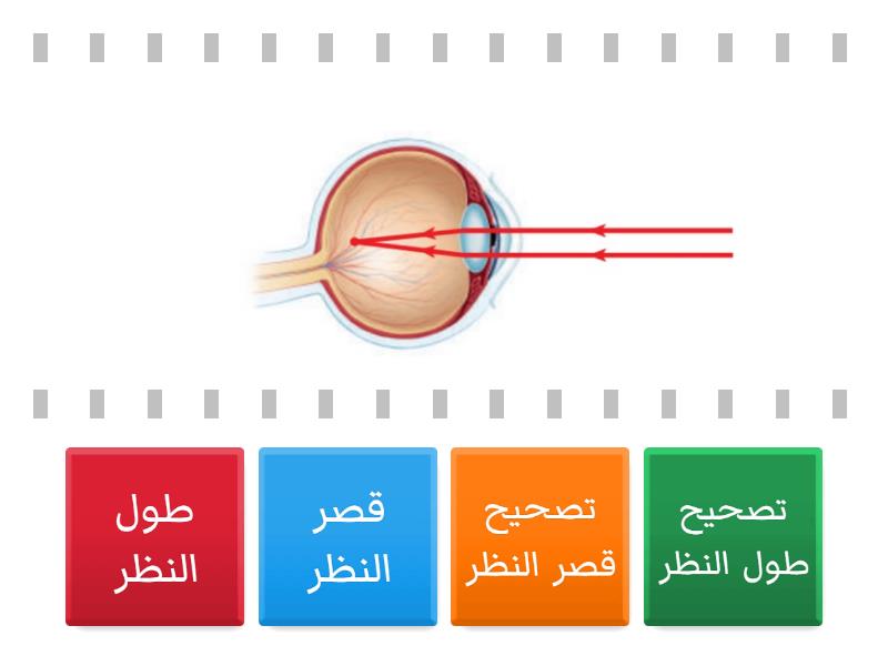 عيوب الابصار - Find the match