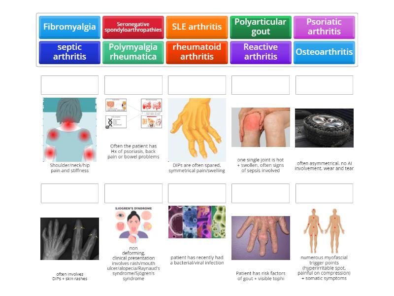 Differentials of joint swelling/pain Match up
