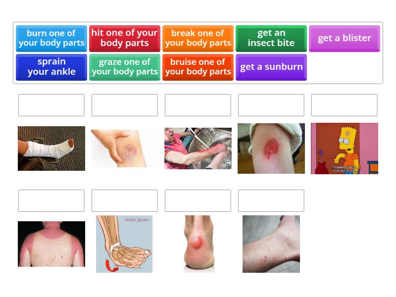 Injuries (phrases) - Match up