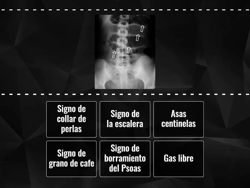 Signos de Rx de abdomen - Cada oveja con su pareja