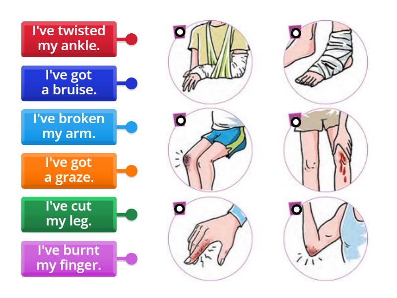 GG3_ Injuries - Labelled diagram