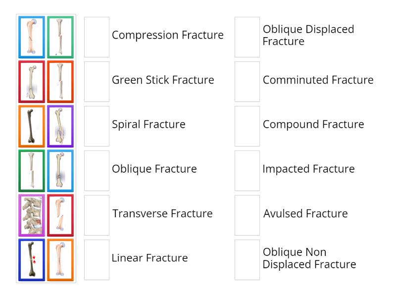 Fracture Match - Match up