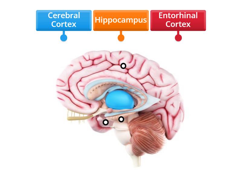 What parts of the brain do Alzheimer's target? - Labelled diagram