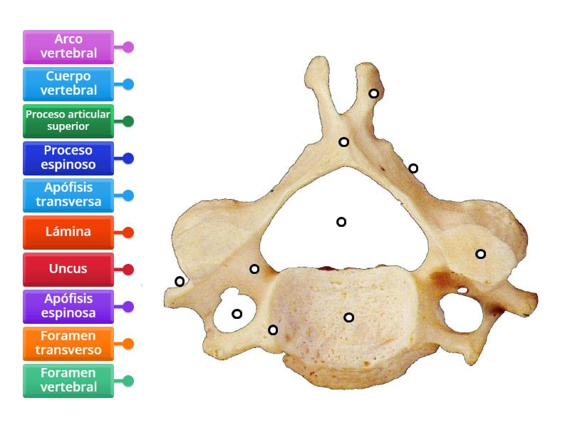 Vertebra cervical - Labelled diagram