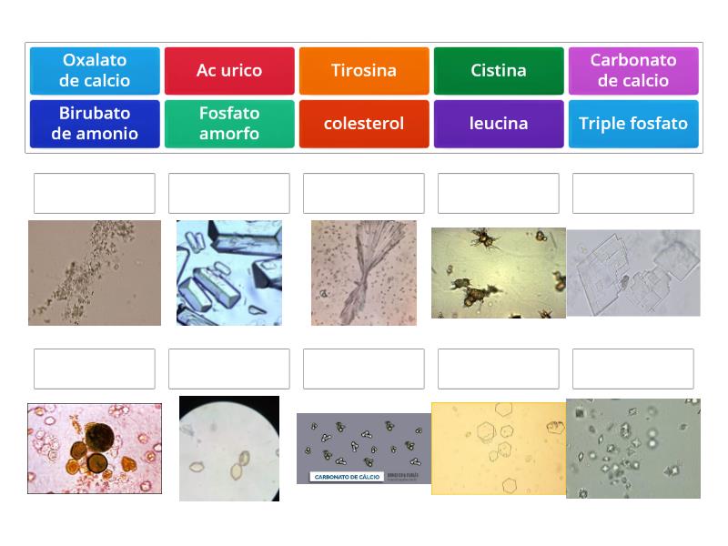 Cristales urinarios - Match up