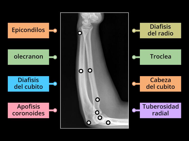 Anatomia rx antebrazo lateral - Labelled diagram