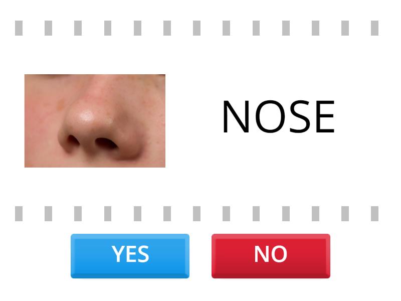 Parts of the face - True or false