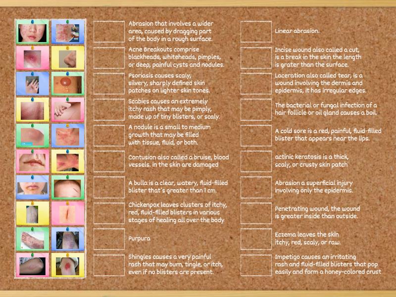 Skin injuries - Une las parejas