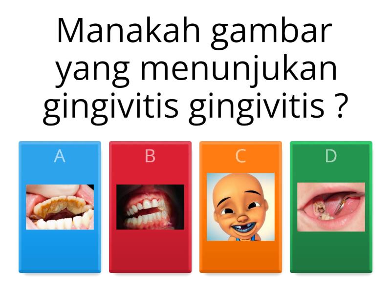 Z GINGIVITIS!!! Quiz