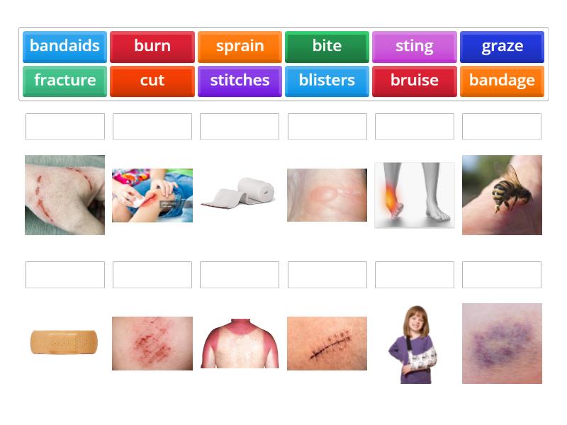 WOUNDS AND INJURIES - Match up