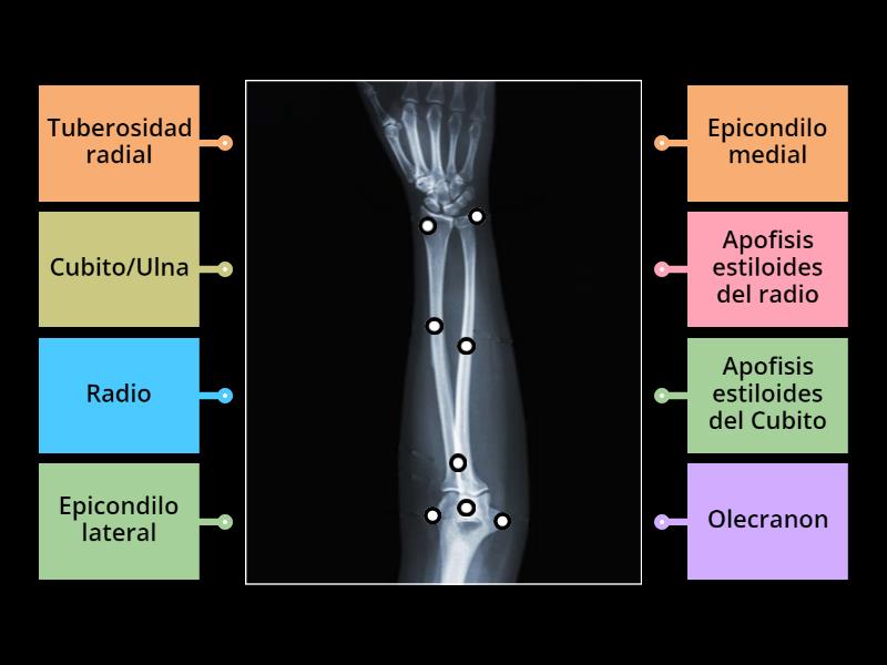 Anatomia Rx antebrazo ap - Diagrama con etiquetas