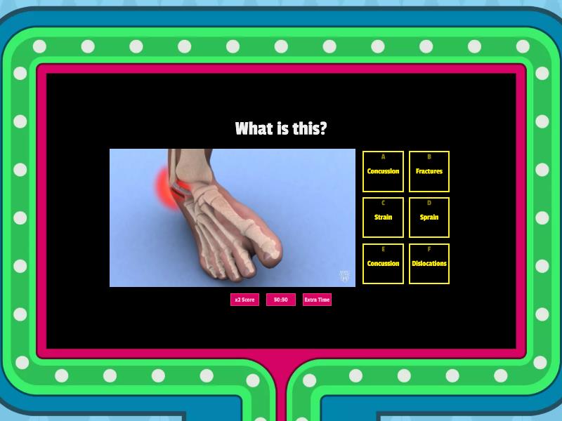 Common Sports-Related Injuries - Gameshow Quiz