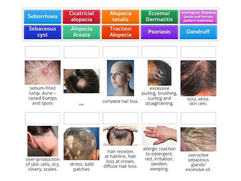 non-contagious-skin-and-scalp-conditions-match-up
