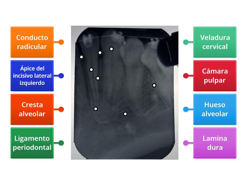 Pr Ctica Proyecci N De Canino Inferior Izquierdo Diagrama Con