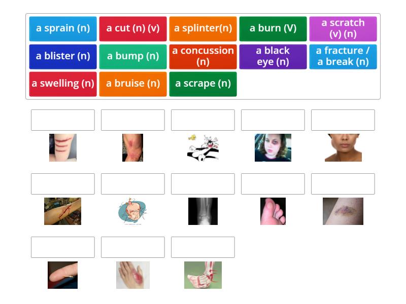 Common Injuries - Match up